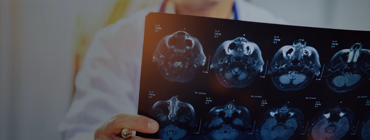 A neurologist examining MRI brain scans